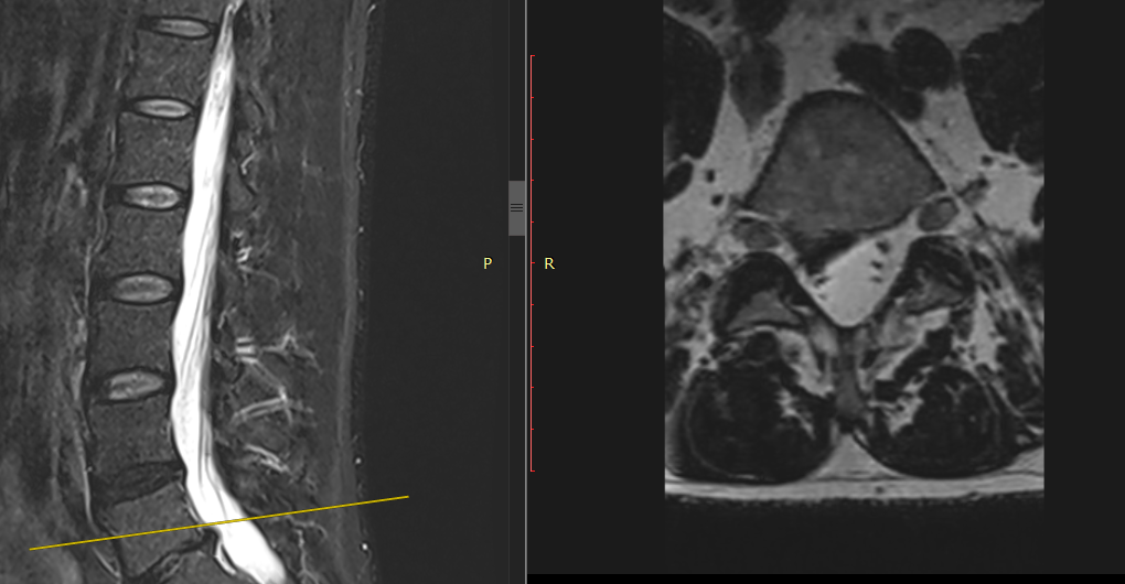 Illustration du cas clinique
